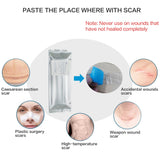 MIRACLE Scar Removal Patch